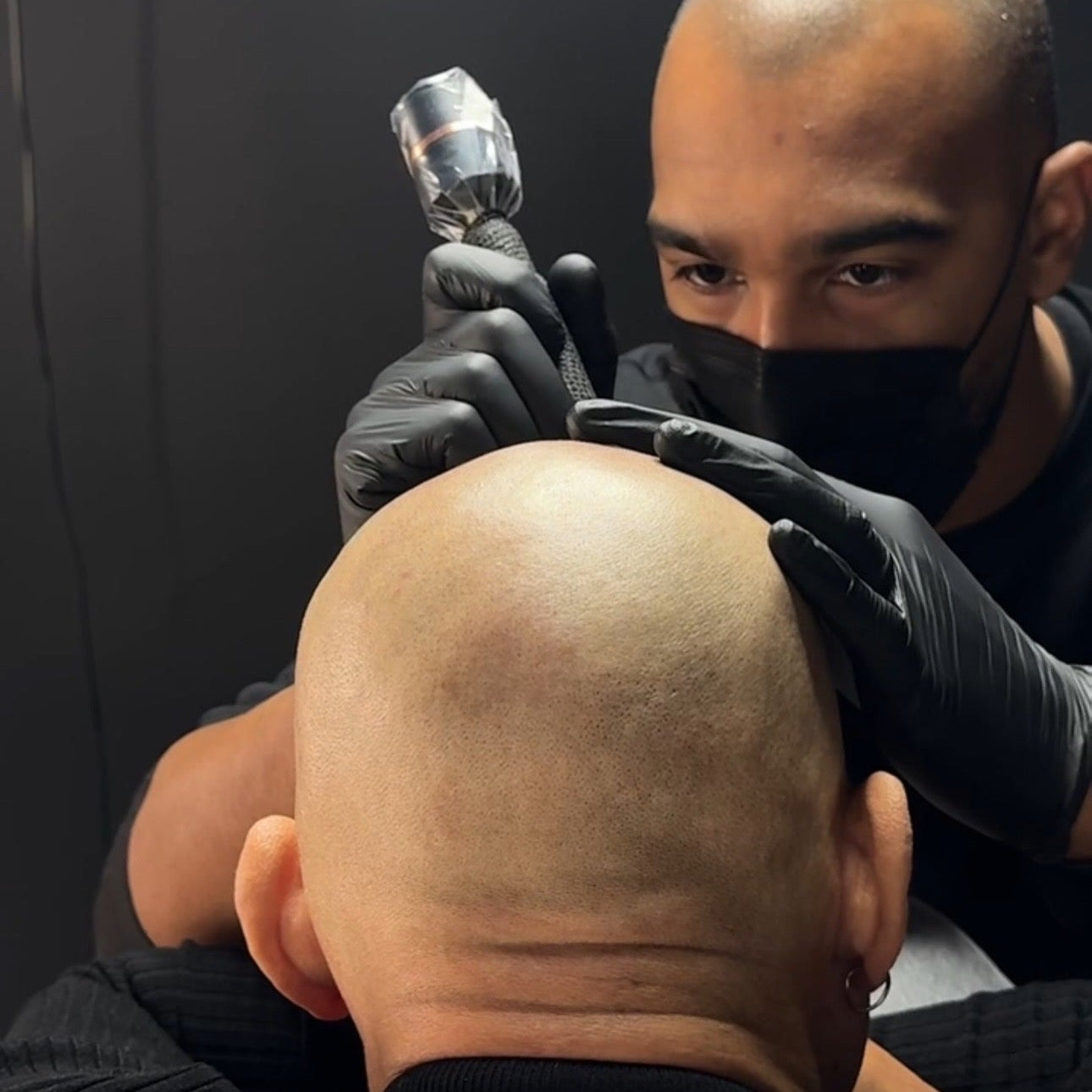 Protocole Tricopigmentation – 3 à 4 Séances, 15h de Restauration