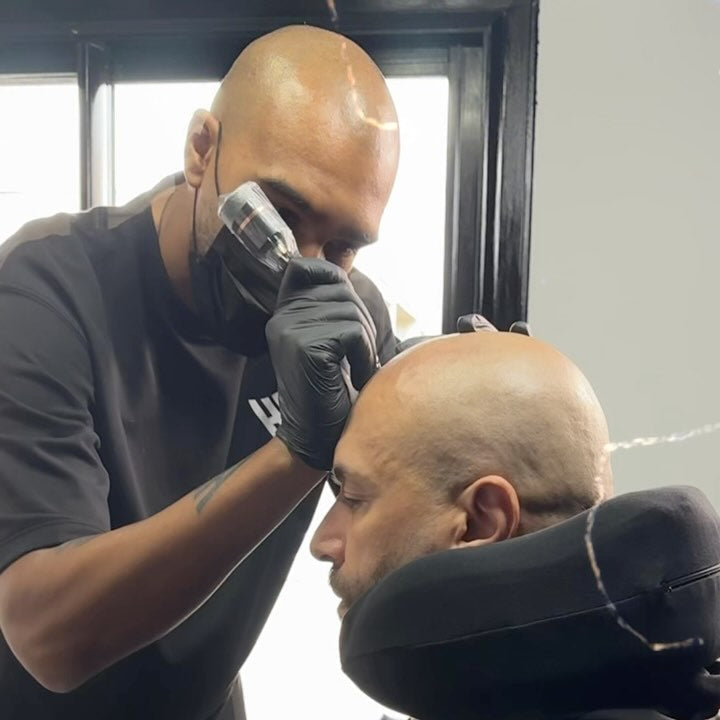 Pigment et tricopigmentation - Oui, c'est un tatouage capillaire